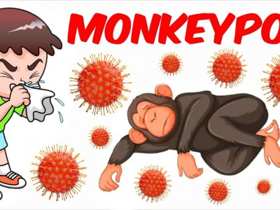 PREVENT | MONKEYPOX |POXVIRUS