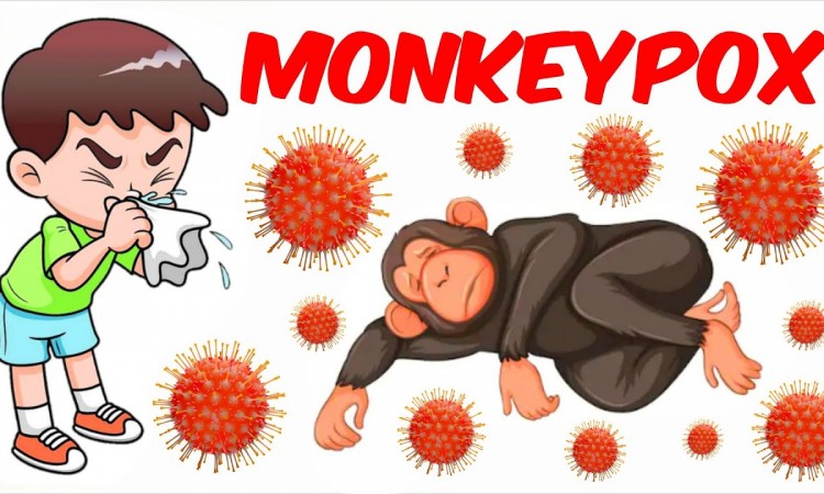 PREVENT | MONKEYPOX |POXVIRUS